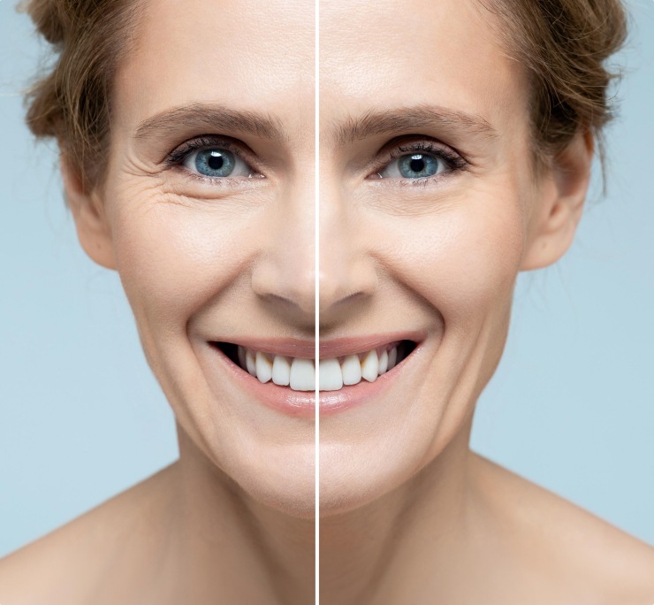 A Gradual But Lasting Skin Transformation